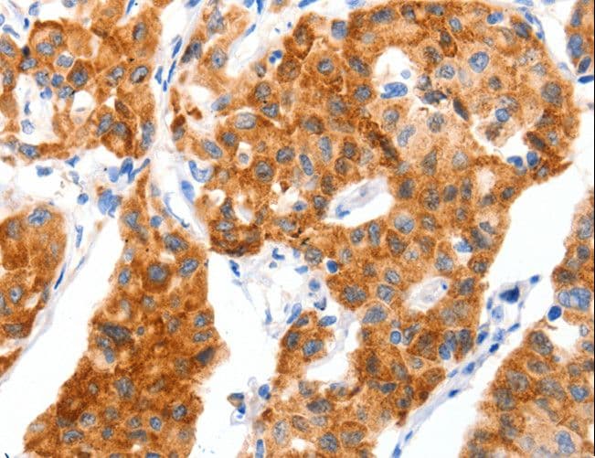 SLC2A4 / GLUT-4 Antibody
