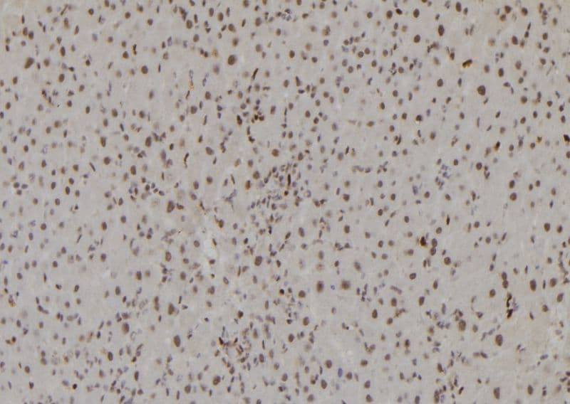 HIST3H3 Antibody (Methyl-Lys27)