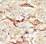 FGFR3 Antibody (aa776-806)