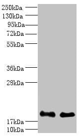 PPP3R1 / Calcineurin B Antibody