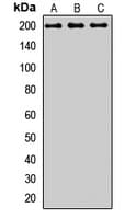 MRC2 / Endo180 Antibody
