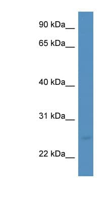 MANF / ARMET Antibody (aa103-152)
