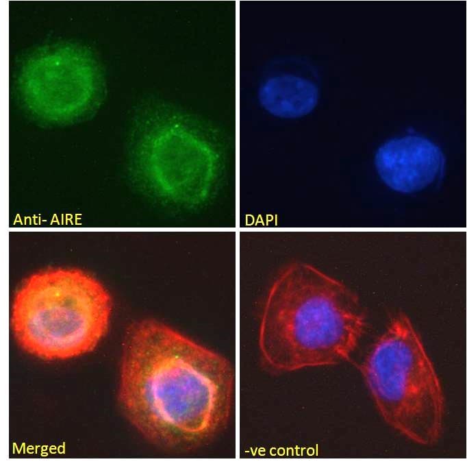 IHC-plus™ AIRE Antibody (aa534-545)