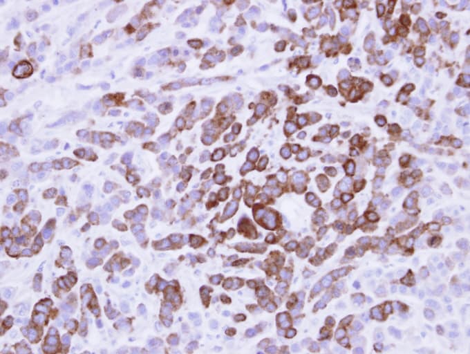 MX1 / MX Antibody (aa1-276)