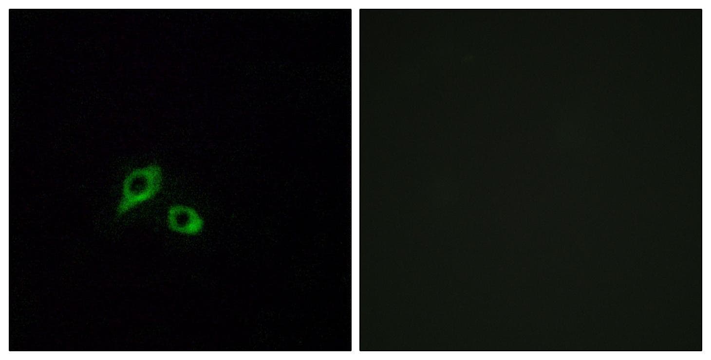 Polyclonal Rabbit anti-Human GIPR / GIP Receptor Antibody (IHC, IF)