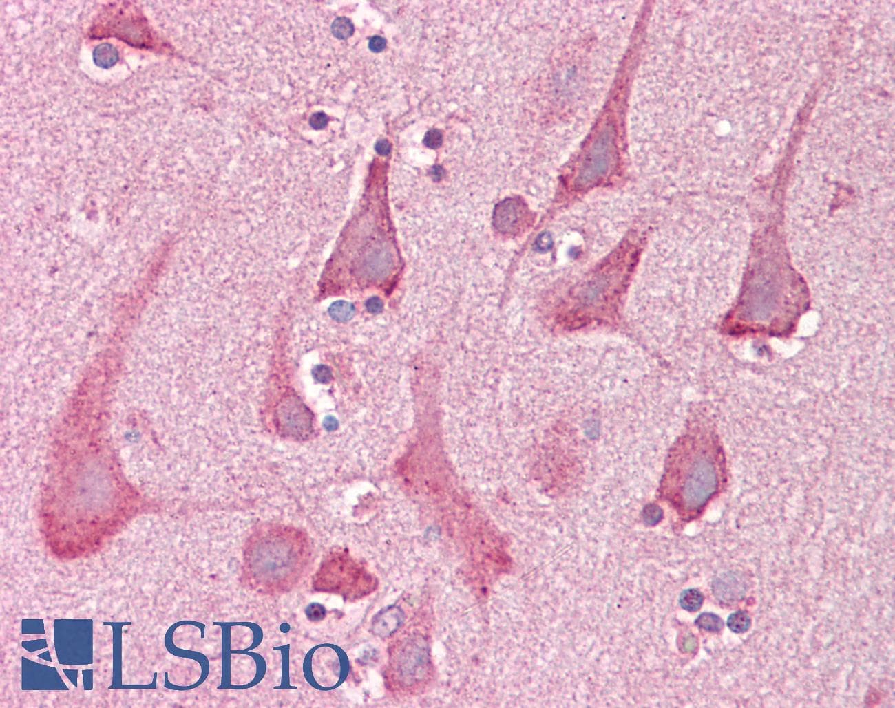IHC-plus™ Rho Kinase / ROCK1 Antibody