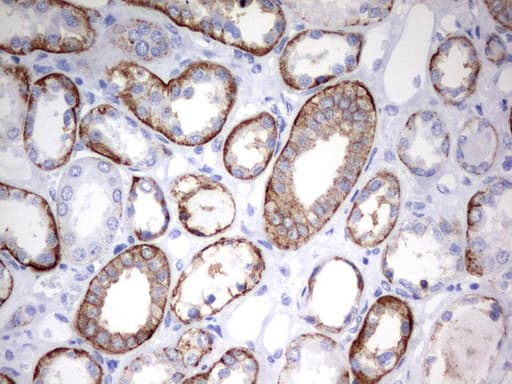 EPCAM Antibody (clone UMAB132)