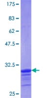 Human LASS1 Protein (Recombinant GST, N-terminus)
