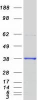 Human RD / PHYH Protein (Recombinant Myc-DDK (Flag))