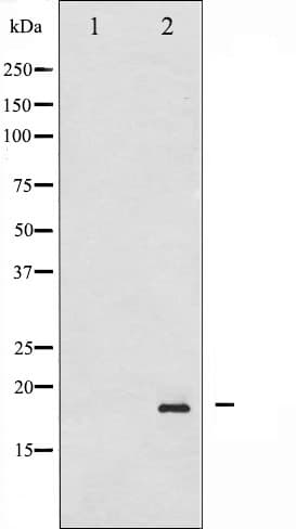 SNCA / Alpha-Synuclein Antibody (phospho-Ser129)
