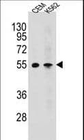 Polyclonal Rabbit anti-Human MCHR1 Antibody (aa396-422, IHC, WB)