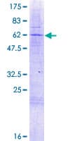 Human FCRLB / FREB-2 Protein (Recombinant GST)
