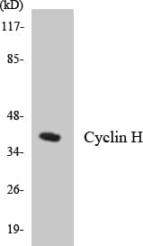 IHC-plus™ CCNH / Cyclin H Antibody (aa262-311)
