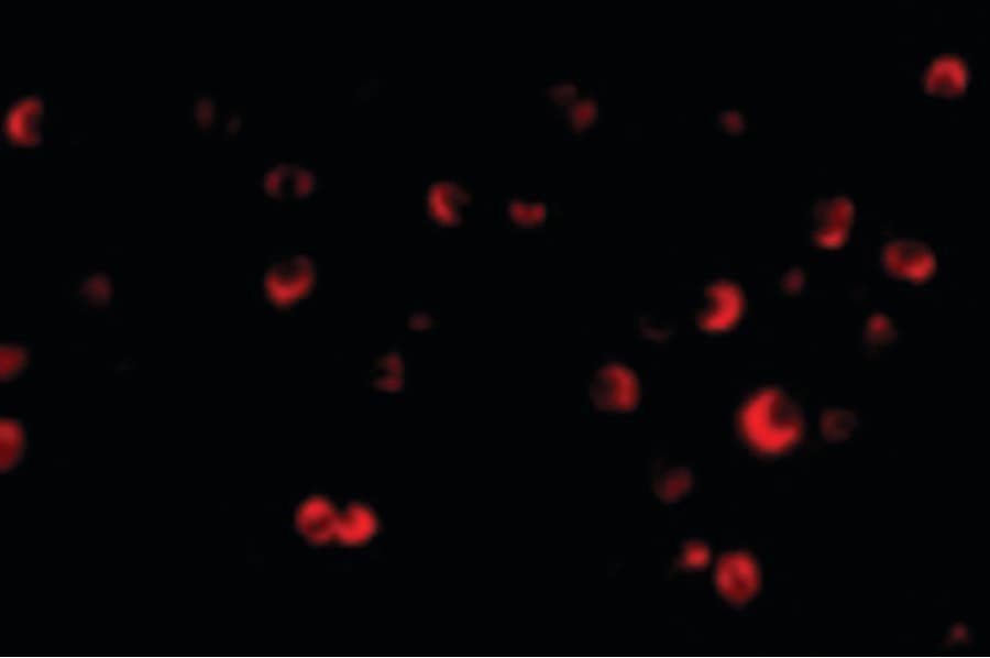 IHC-plus™ Polyclonal Rabbit anti-Human Tuberin / TSC2 Antibody (IHC, IF, WB)