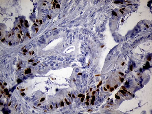 RACGAP1 / MGCRACGAP Antibody (aa123-238, clone OTI3A5)