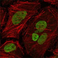 IHC-plus™ MLH1 Antibody (clone 4C9C7)