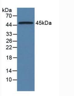 ORM1 / Orosomucoid Antibody