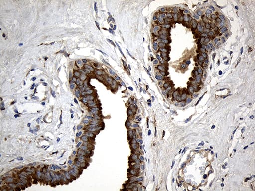 Monoclonal Mouse anti-Human MGP / Matrix Gla-Protein Antibody (clone OTI8D6, IHC, WB)