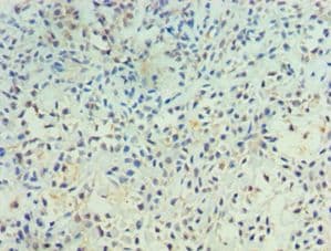 Polyclonal Rabbit anti-Human PTPRA / RPTP-Alpha Antibody (aa20-142, IHC)