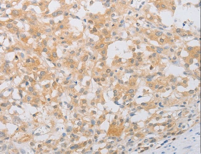 Polyclonal Rabbit anti-Human PDE4D Antibody (IHC, WB)