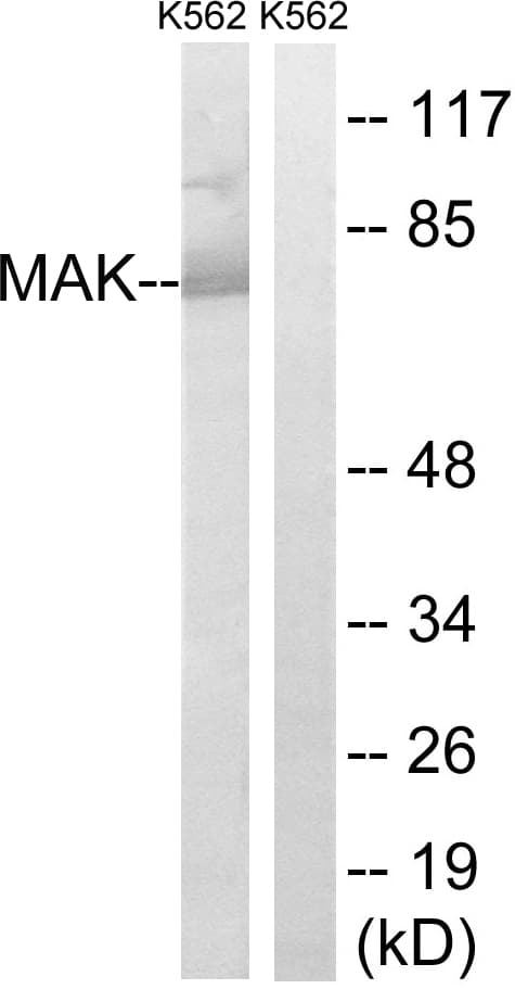 MAK Antibody (aa126-175)