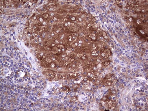 Monoclonal Mouse anti-Human PKM2 Antibody (clone 1F12, IHC, WB)
