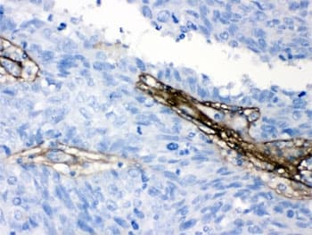 COL1A1 / Collagen I Alpha 1 Antibody (aa1194-1218)