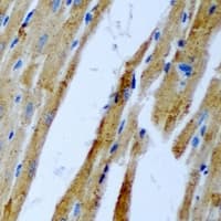 PLEK / Pleckstrin Antibody