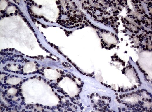 MGMT Antibody (clone UMAB52, Carrier-free)