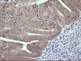 MAP2K3 / MEK3 / MKK3 Antibody (clone OTI4B3)