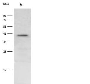 HAO1 Antibody (Preservative Free)