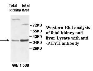 RD / PHYH Antibody (aa34-321)
