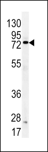 CT26 / DDX53 Antibody (aa597-626)