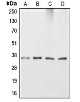 Polyclonal Rabbit anti-Human APOE / Apolipoprotein E Antibody (Internal, IHC, WB)