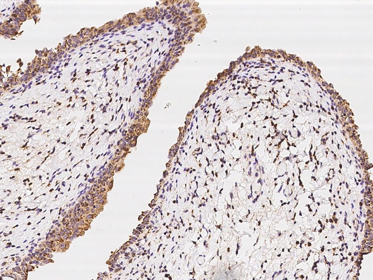 Polyclonal Rabbit anti-Human LIMK1 / LIMK Antibody (IHC)