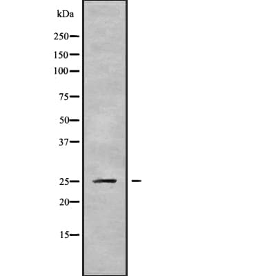 PSMD9 / 26S Proteasome Antibody