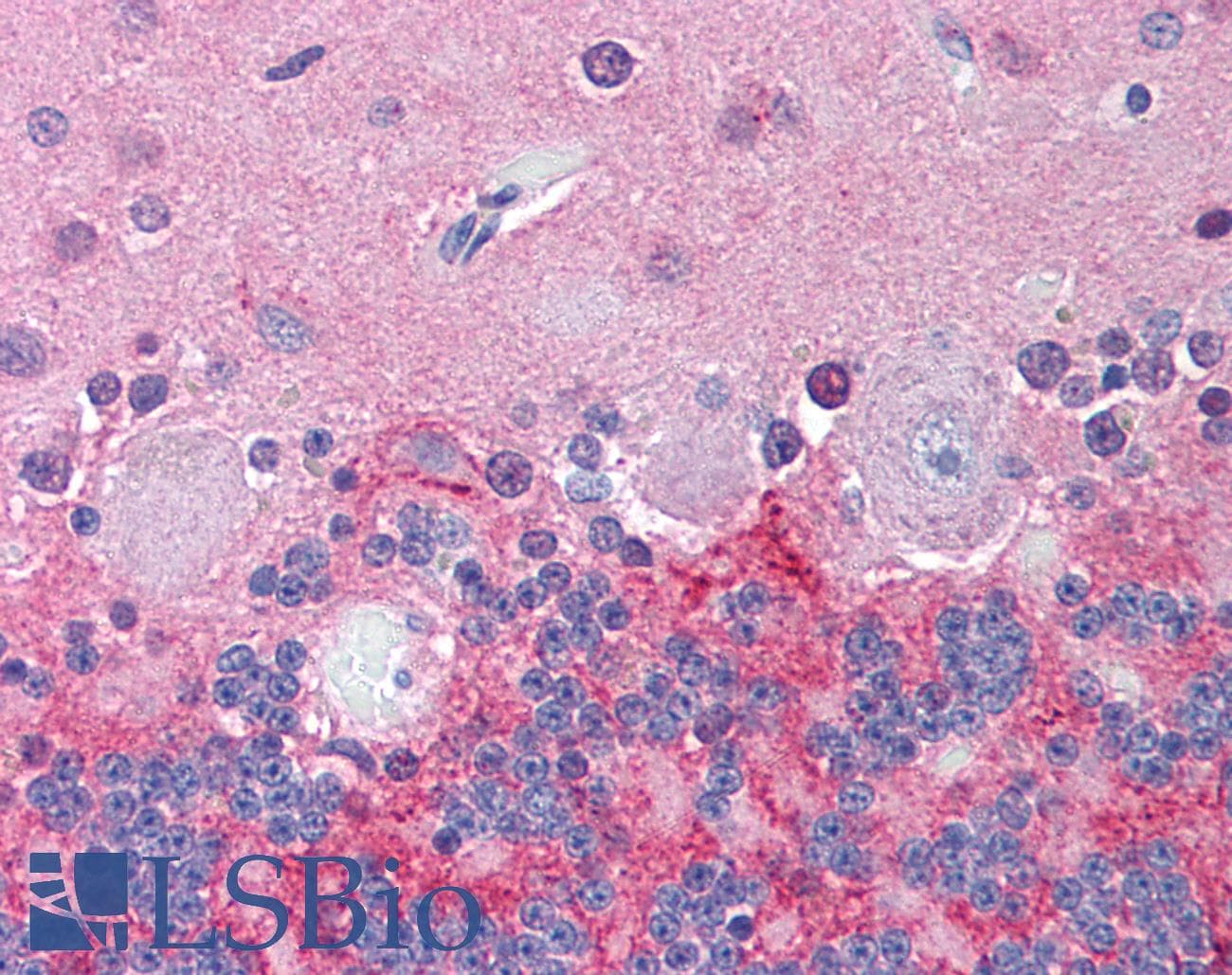 IHC-plus™ Polyclonal Rabbit anti-Human KCNJ6 / GIRK2 Antibody (N-Terminus, IHC)