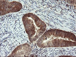 PPAT Antibody (aa42-278, clone OTI1B11)