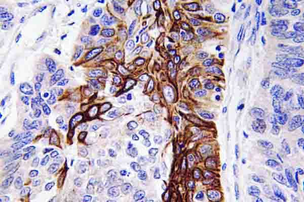 SLC2A4 / GLUT-4 Antibody (Arg271)