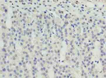 ZNF215 Antibody