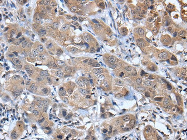 CXCL5 Antibody