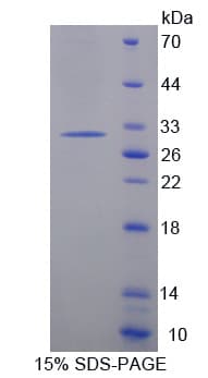 Mouse CNTN6 / Contactin 6 Protein (Recombinant His-T7)