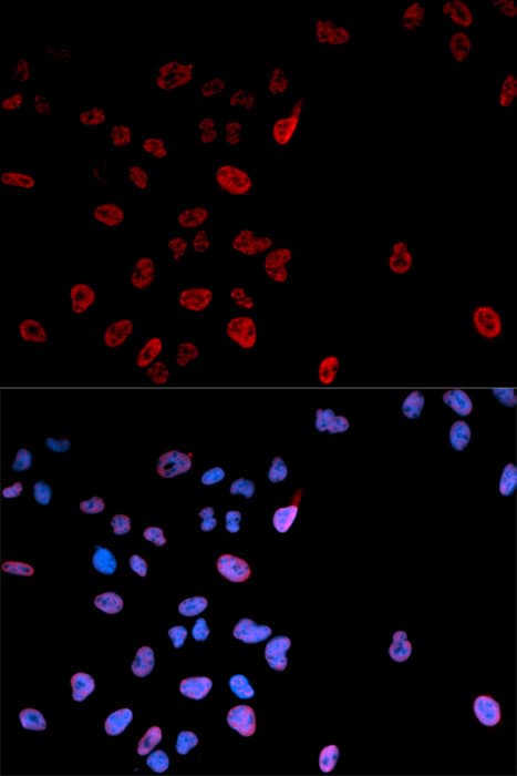 MYC / c-Myc Antibody (phospho-Ser62)