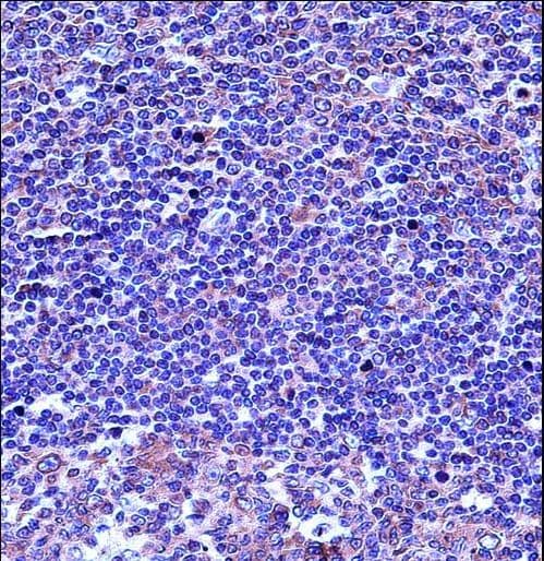 TUBA4A / TUBA1 Antibody (aa417-446)