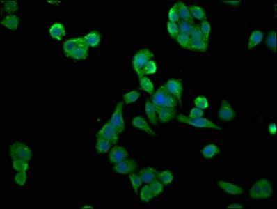 IHC-plus™ CSNK2A2 Antibody