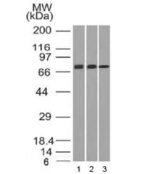 CD105 Antibody (clone ENG/1326)