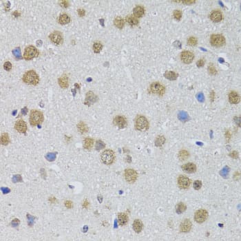 DMAP1 Antibody (AP)