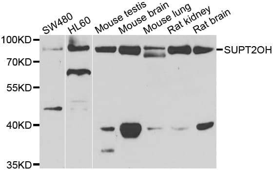 Polyclonal Rabbit anti-Human FAM48A / P38IP Antibody (IHC, IF, WB)