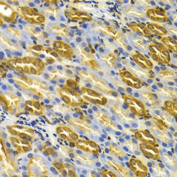 IHC-plus™ TCP1 Antibody
