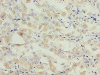 Polyclonal Rabbit anti-Human GCSAML / C1orf150 Antibody (IHC)
